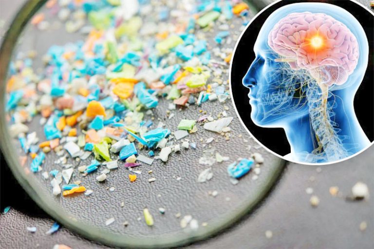 Plastic pollution is being shown to have serious impacts on human brain health. In particular, the increasing levels of microplastics in the brain have become a cause for concern.